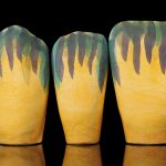 Prettau_Anterior_02-150×150