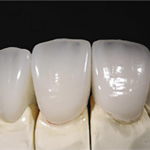 teaserbox_41056212-150×150